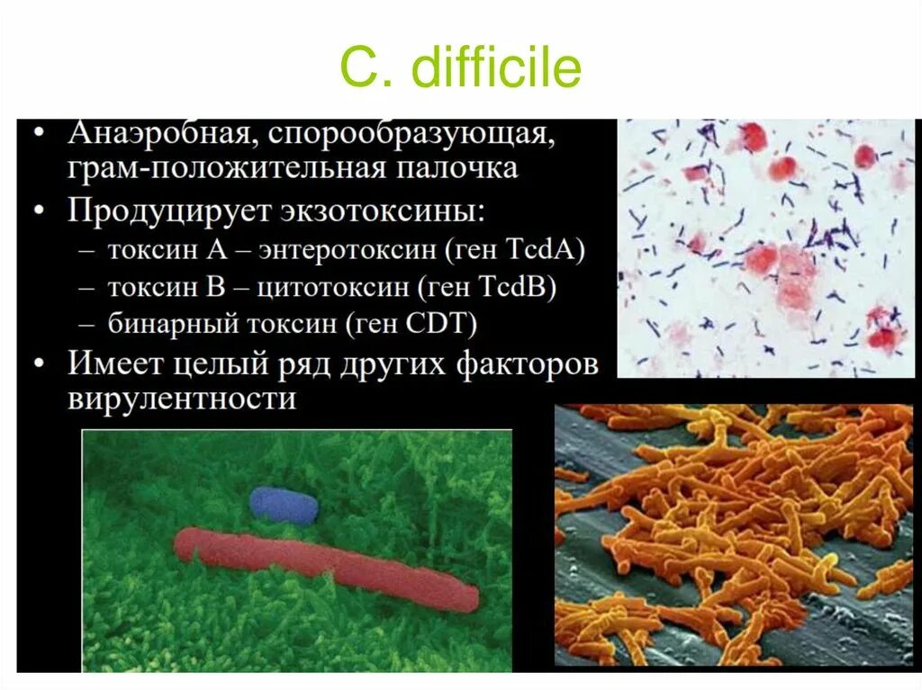 Клостридиум диффициле. Токсин клостридии диффициле. Клостридия диффициле под микроскопом. Clostridium difficile что это