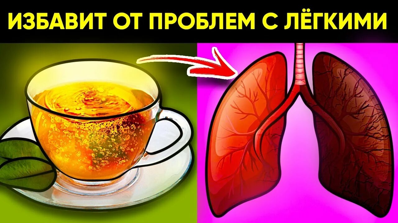 Иммунитет легких. Для иммунитета легких. пневмония иммунитет.