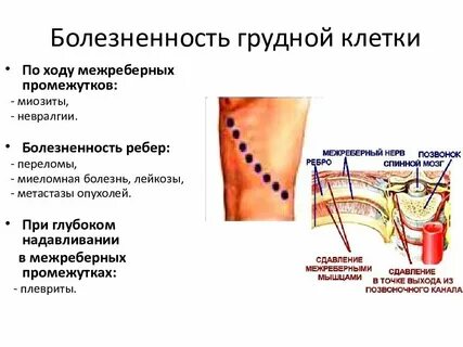 Межреберная невралгия грудного отдела симптомы