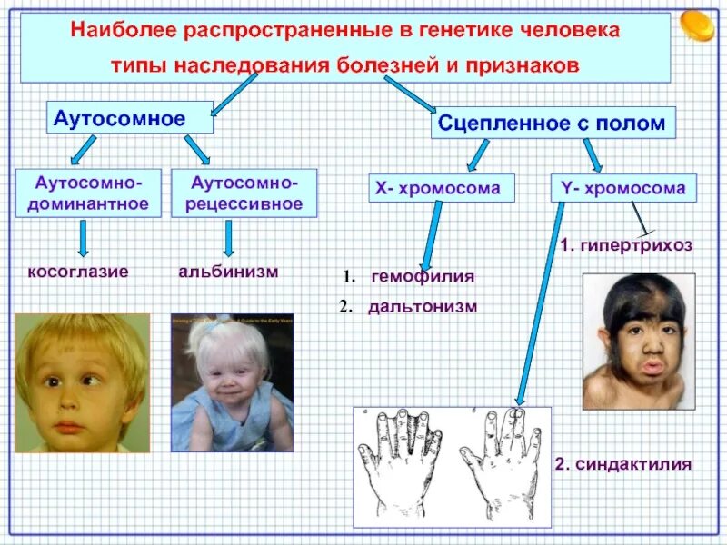 Наследственная синдактилия Тип наследования. Типы наследования признаков схема. Типы наследования признаков у человека. Наследственные признпк. Форма изменчивости дауна