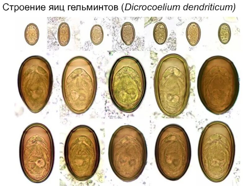 Яйца гельминтов Dicrocoelium lanceatum. Атлас яйца гельминтов жвачных. Строение яиц гельминтов. Яйца ланцетовидной двуустки. Купить яйца глист