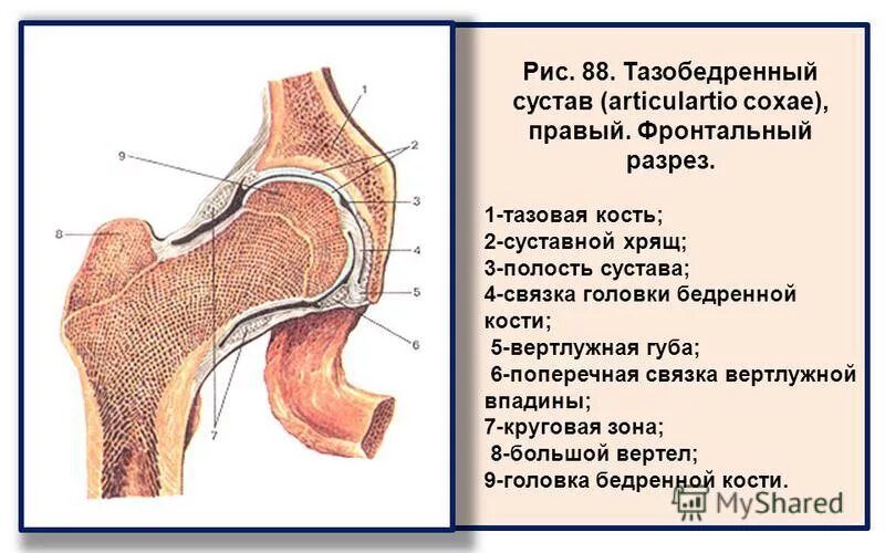 Связка головки. Тазобедренный сустав анатомия вид спереди. Тазобедренный сустав анатомия строение. Фронтальный распил правого тазобедренного сустава. Поперечная связка вертлужной впадины тазобедренного сустава.