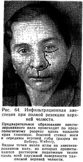 Желваки