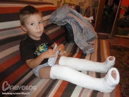 Гипс детский