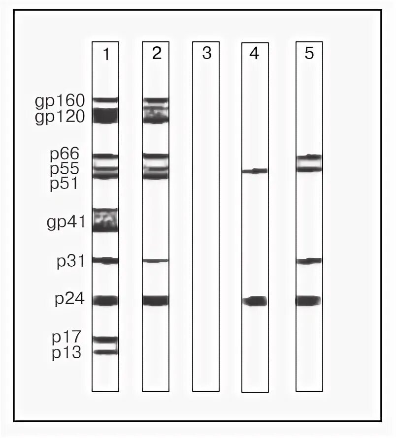 Иммуноблот ВИЧ. Иммуноблоттинг при ВИЧ. Иммунный блоттинг. ВИЧ тест иммунный блоттинг.