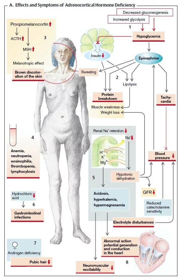 Избыток гормона кортизола. Признаки повышенного кортизола у женщин. Повышение кортизола у женщин симптомы. Переизбыток кортизола симптомы.