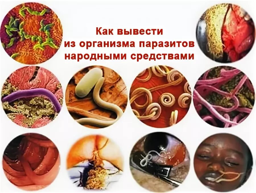 Как выводят глистов из организма. Паразиты в организме человека. вывести паразитов из организма. как вывести паразиты из организма человека. продукты для выведения паразитов из организма.