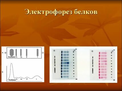 Электрофорез белков принцип метода