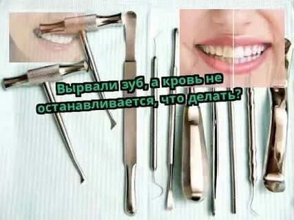 Кровоточащий удаление