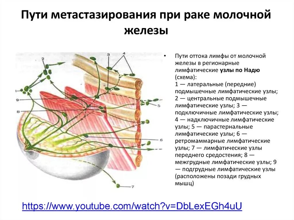 Рак молочной железы лимфатические узлы