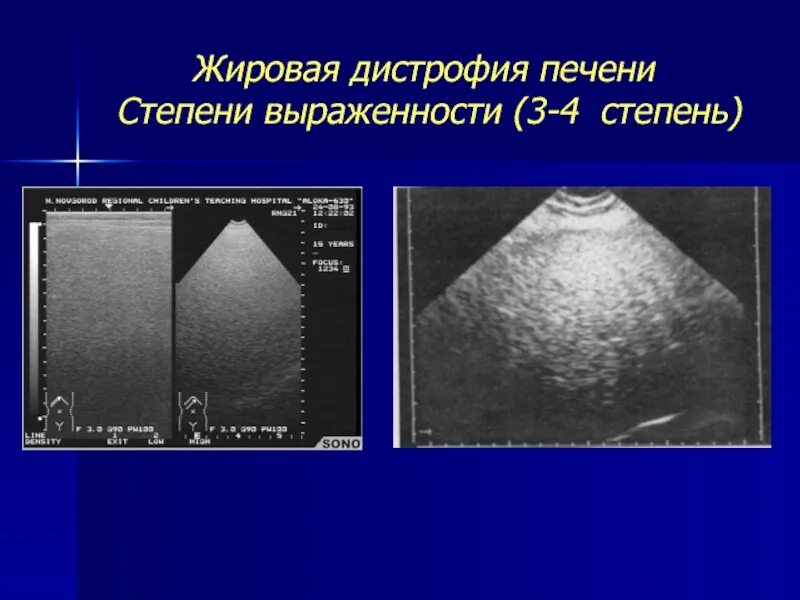 Как обследовать печень полностью