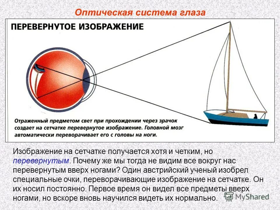 Почему человек видит прямое изображение. Изображение на сетчатке. Зрение перевернутое изображение. Изображение предмета на сетчатке. Перевернутое изображение на сетчатке глаза.