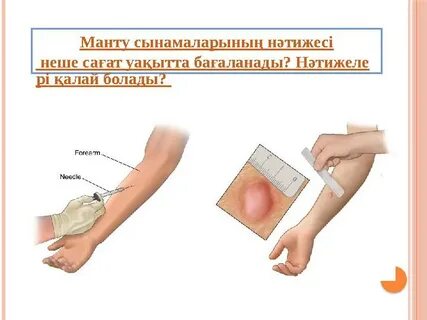 Викамен ресейлік секс