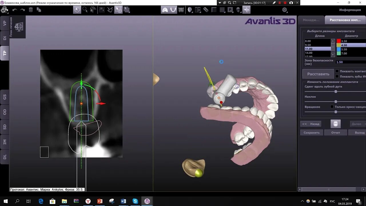 3d моделирование зубов программа. 3d diagnosis программа. 3d-моделирования avantis. Cad cam моделирование зубов. Авантис 3д стоматология.