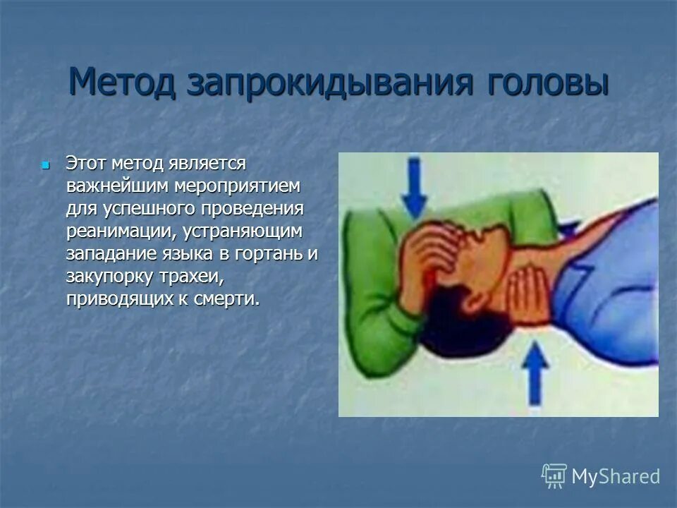 День запрокидывания головы 28 августа картинки. День запрокидывания головы 28 августа картинки