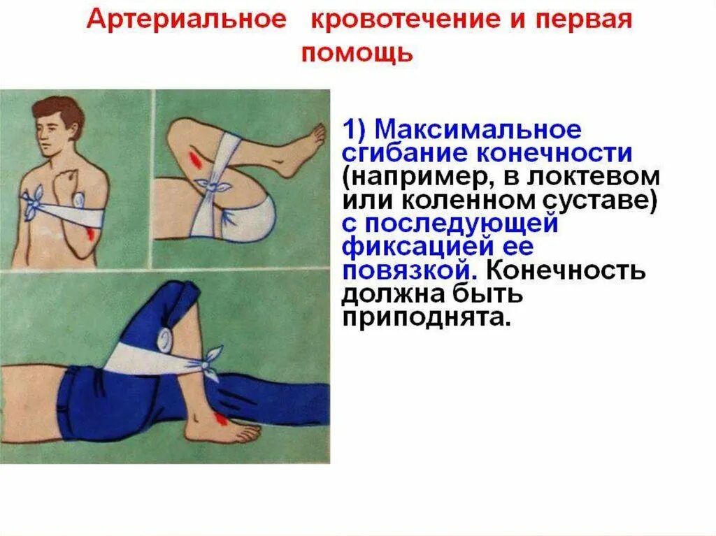 Кровотечение конечностей. Артериальное кровотечение пмп. порядок пмп при артериальном кровотечении. артериальное кровотичениепервая помощь. первая помощь при аптериальном крово.