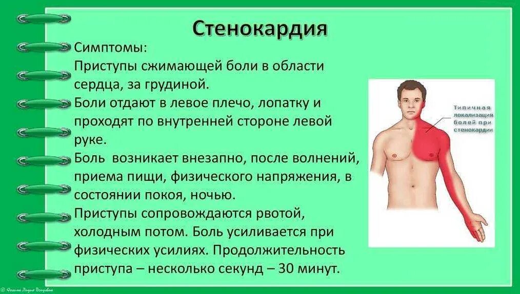 Какие симптомы приступа. Грудная жаба симптомы. стенокардия симптомы. признаки стенокардии. стенокардия симптомы у мужчин.