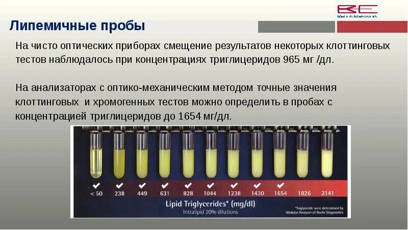 Проба сыворотки крови. Иктеричность сыворотки крови. Гемолиз хилез иктеричность. Степень липемии иктеричности и гемолиза что это. Эктеричность сыворотки.