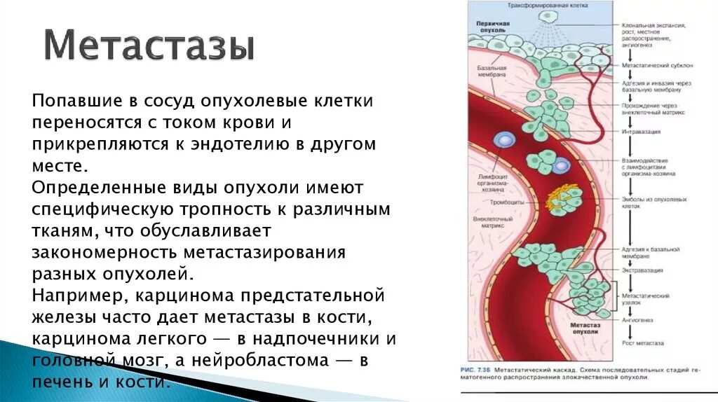 Термины при интерпретации результатов КТ и рентгена ОГК, термины и определения п