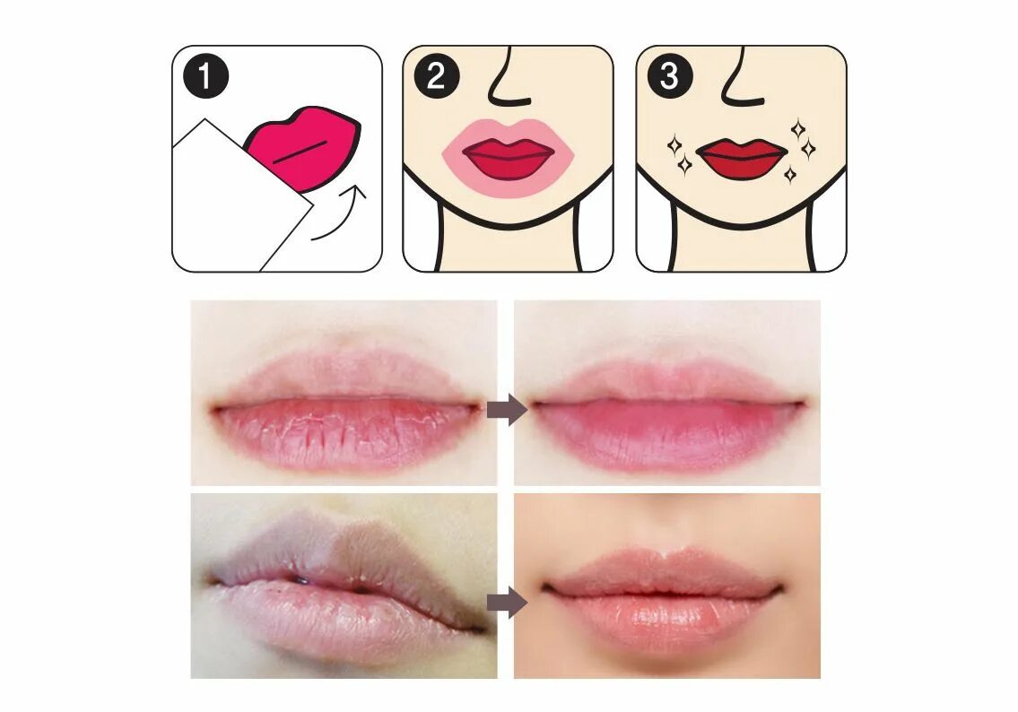 Zozu lip mask. Zozu lip mask