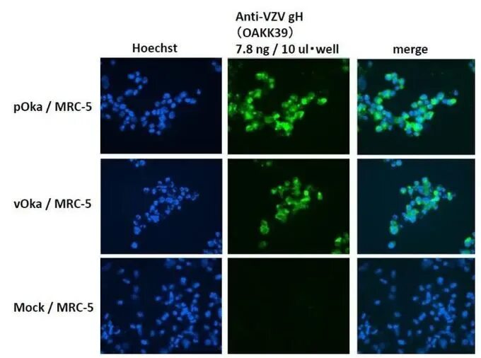 Varicella zoster вирус IGG 1000. MRC-5 клетки.