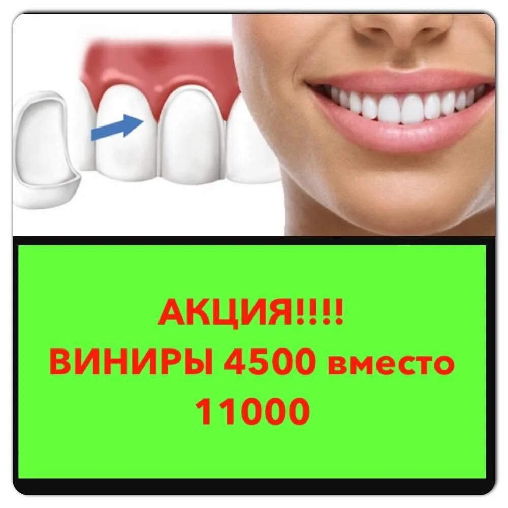 Сколько стоят зубы продать