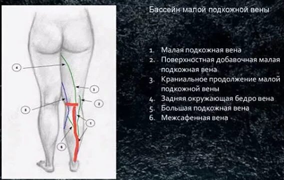 Венозный бассейн. Бассейн малой подкожной вены. узи анатомия малой подкожной вены. бпв вен нижних конечностей анатомия. вены нижних конечностей анатомия схема.