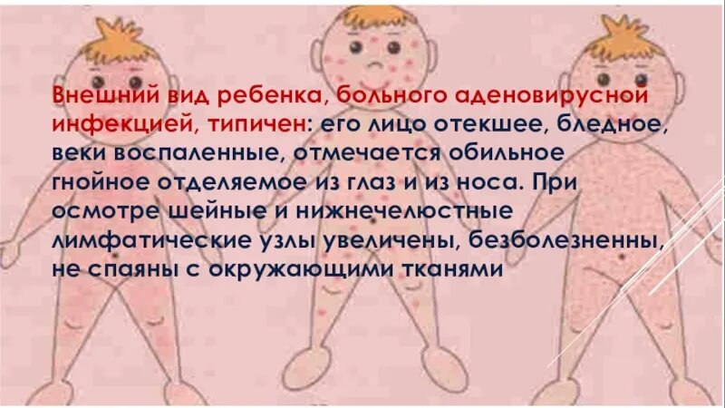 Аденовирус инфекция