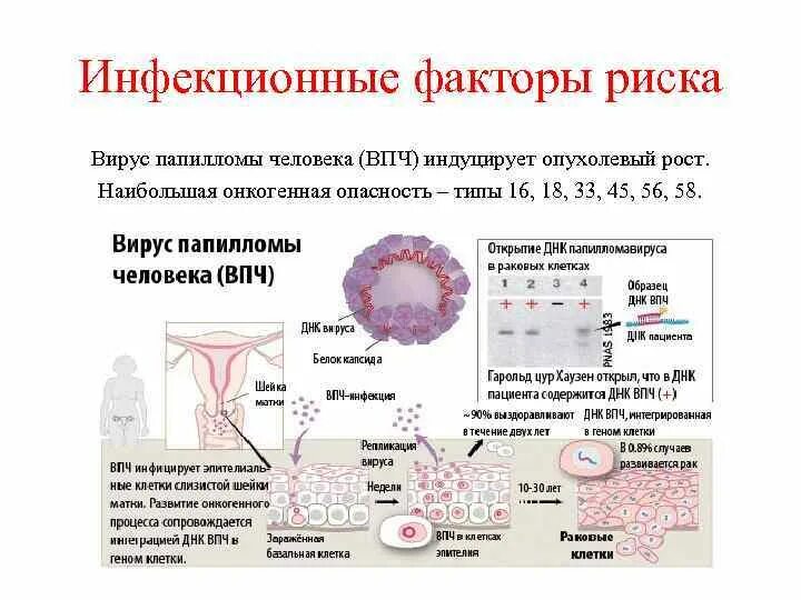 Вирус папилломы человека ВПЧ 16. Папилломавирусная инфекция вызывается.