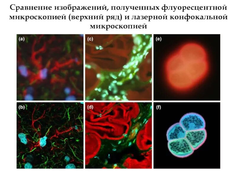 Изображения полученные с помощью. Флуоресцентная и конфокальная микроскопия. Люминесцентная (флуоресцентная) микроскопия. Митохондрия конфокальная микроскопия. Многофотонная флуоресцентная микроскопия.