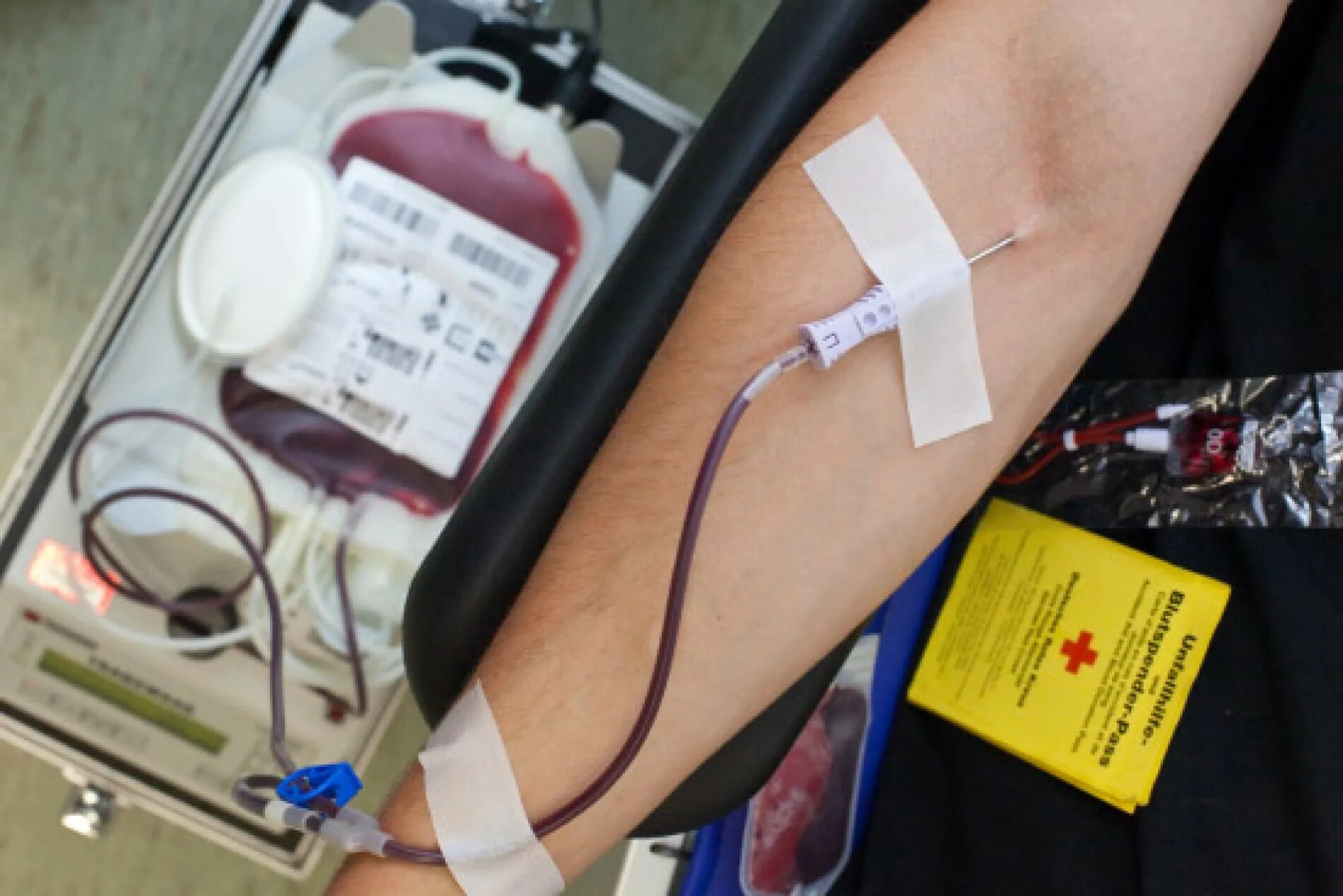 Отвод от донорства. Переливание донорской крови. Системы для забора донорской крови. Забор крови для переливания.