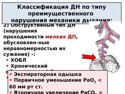 Обструктивный тип