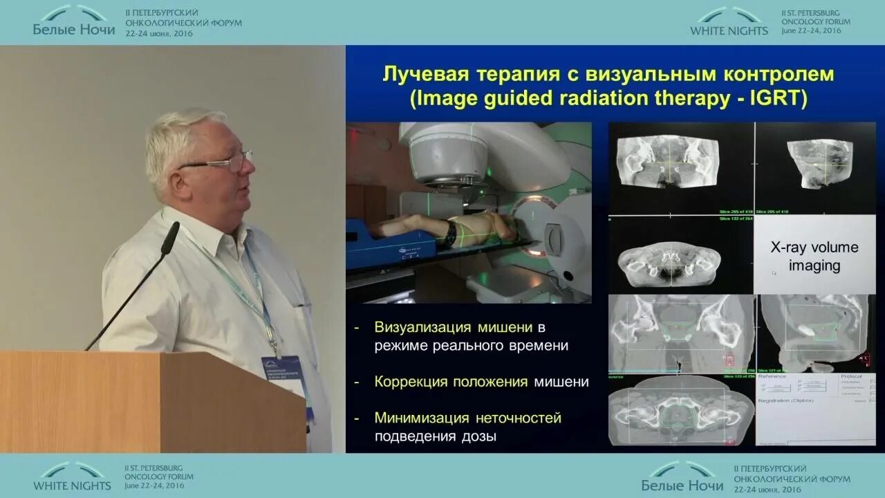Лучевая терапия с визуальным контролем. Дистанционная лучевая терапия предстательной железы. IGRT лучевая терапия. Лучевая терапия при онкологии предстательной железы.