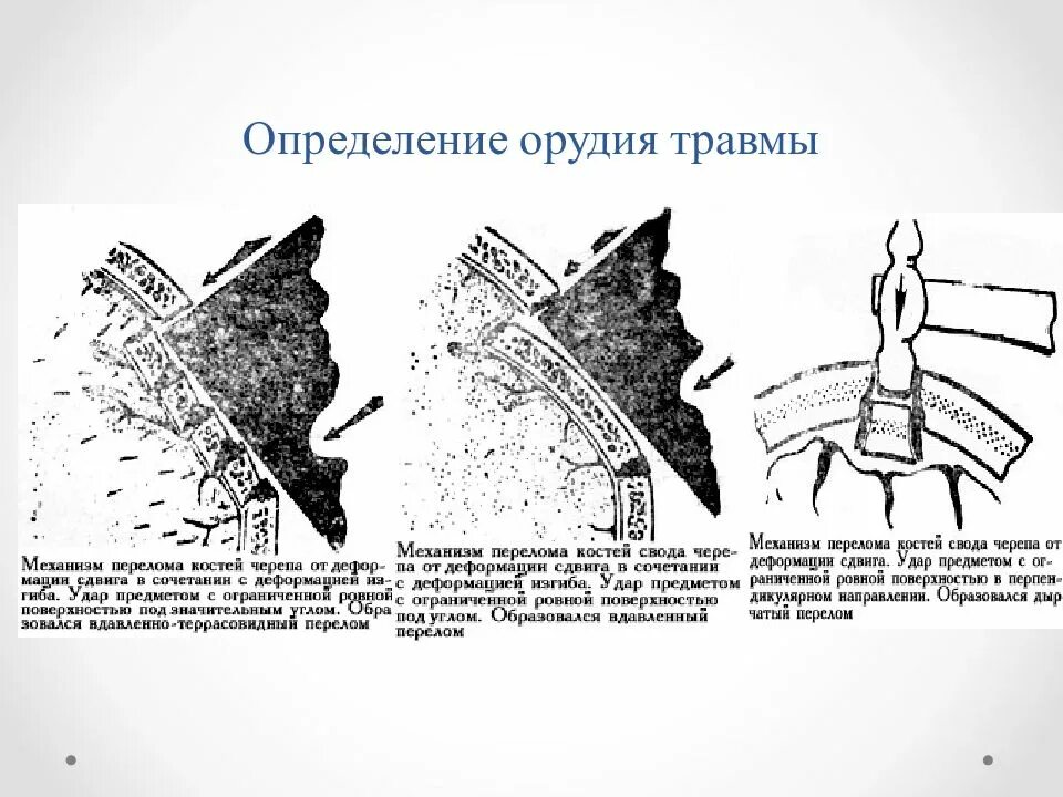 Идентификация орудия травмы. Характеристика орудия травмы. Террасовидный перелом формируют. Механизм образования переломов.