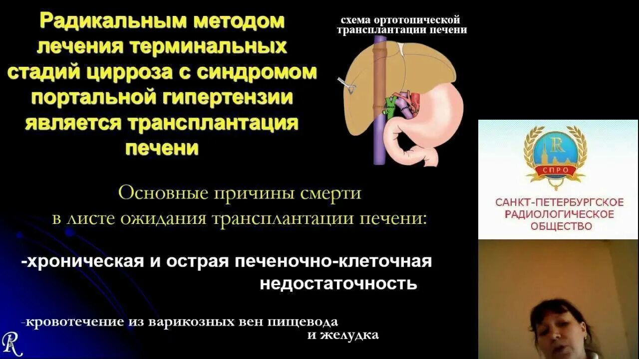 Операция при гипертонии