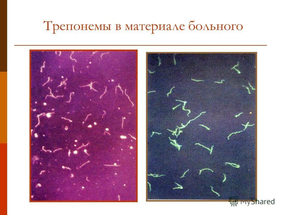 Заболевания вызываемые трепонемой. Трепонема Романовскому Гимзе. Трепонема паллидум микроскопия. Бледная трепонема микроскоп.