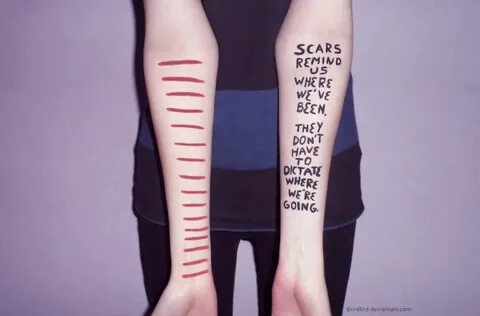 Scars i am they