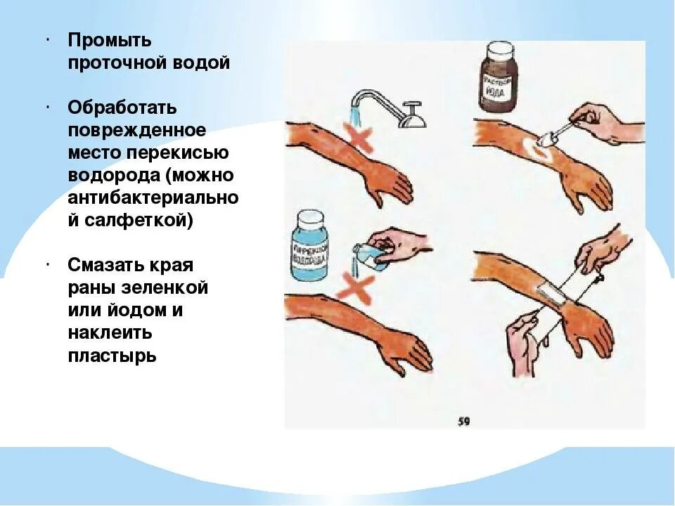 Обработка раны перекисью водорода. Промыть рану перекисью. Промыть рану проточной водой. Смыть водой кровь