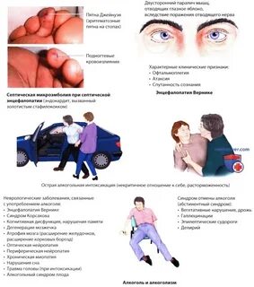 Приобретенные энцефалопатии - характеристика кратко