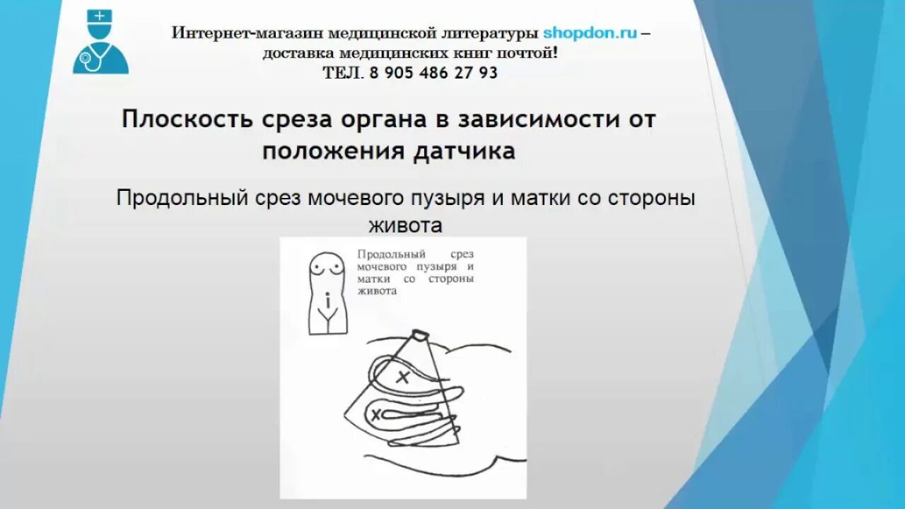 Кодированный градиент. Плоскость среза болта. Плоскость среза болта. Плоскости среза заклепки. Виды срезов в медицине.