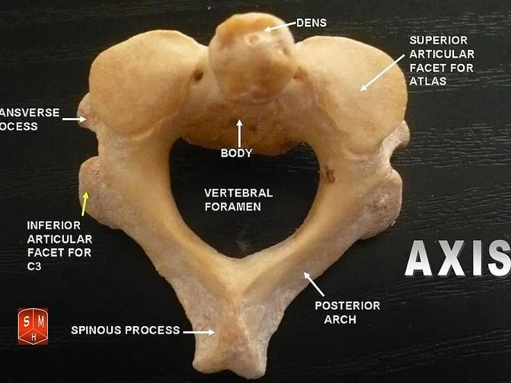 Axis значение. Шейный позвонок аксис анатомия. c2 шейный позвонок. axis c2 vertebrae. axis шейный позвонок.