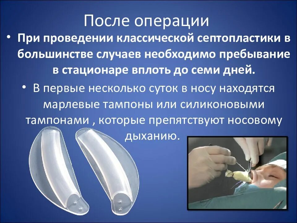 Носовые сплинты силиконовые. Силиконовые сплинты в нос. Гипертрофический ринит искривление носовой перегородки. Сплинты в носу септопластика. Силиконовые шины для носа.