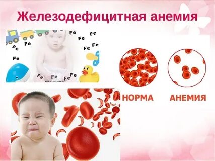 Жда у детей