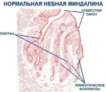 Исследование небных миндалин спб