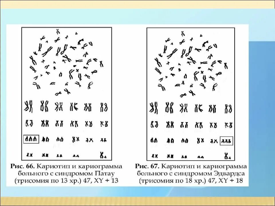 Кариотип человека определяют