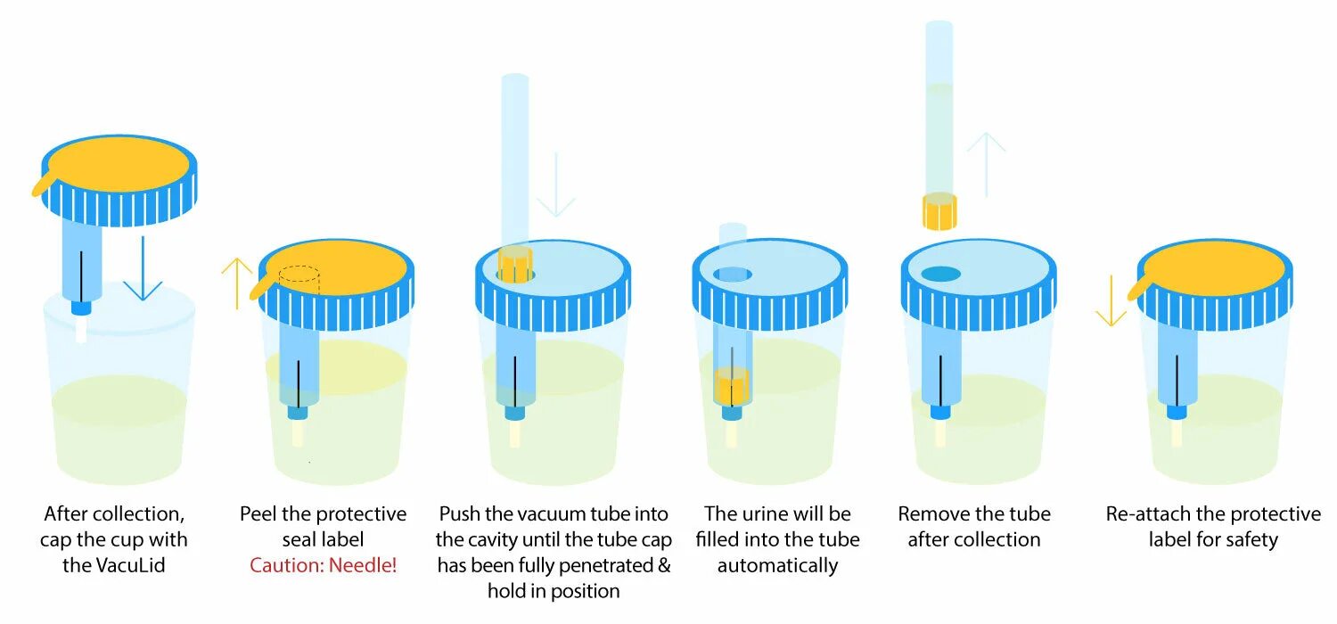 After collection. Urine Testing infographic. Urine z инструкция по применению на русском языке. Magic Mushrooms urine Test. Methods to collect the urine from children.