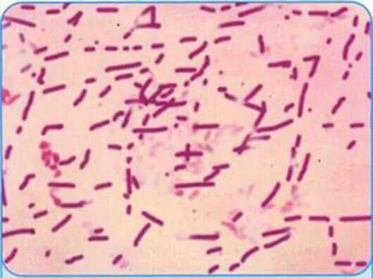 Бациллярная микрофлора. Лактобактерии палочки дедерлейна. lactobacillus мазок. бациллярная(лактобациллы)?. лактобациллы в мазке.