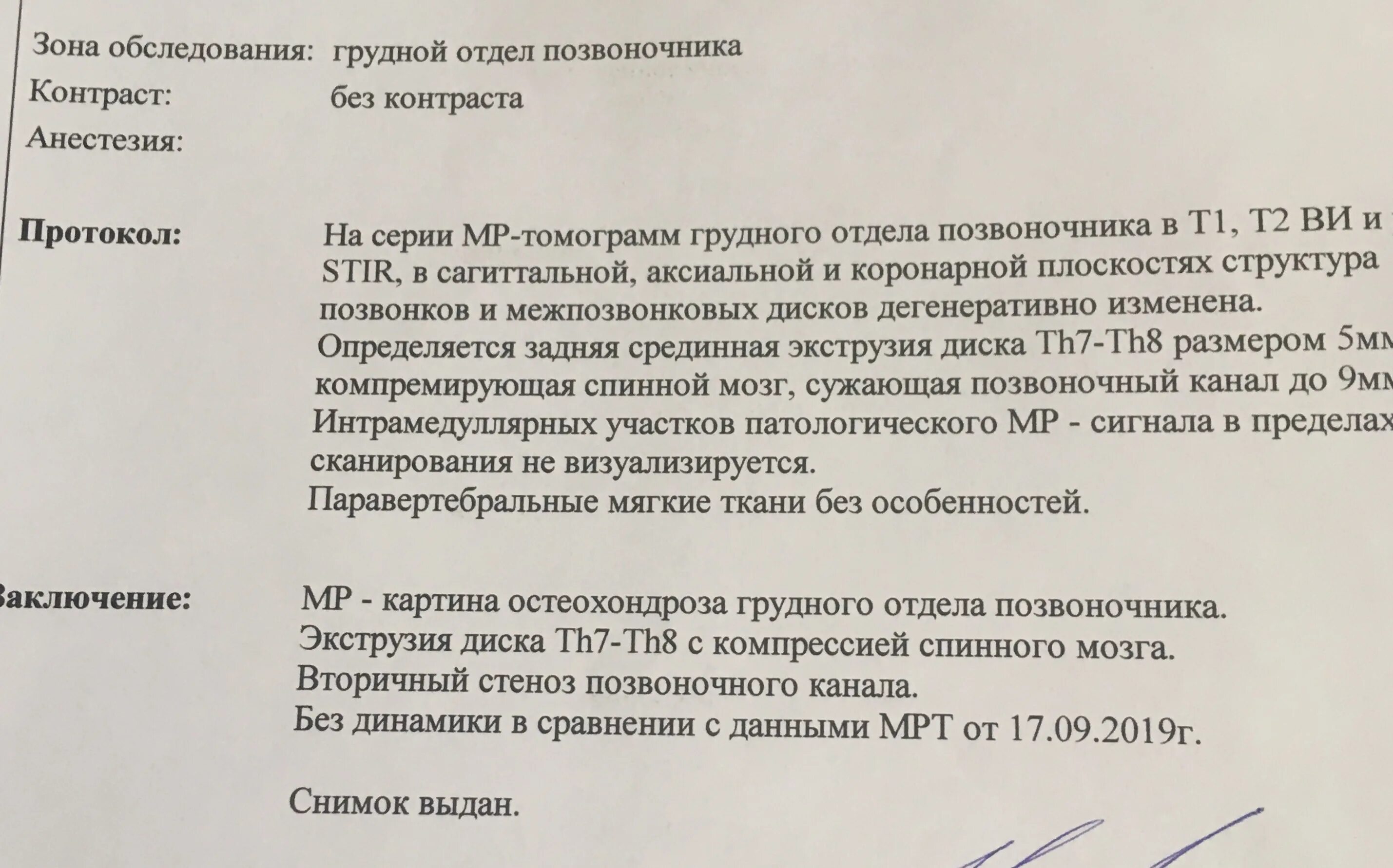 Как лечить стеноз шеи. Стеноз шейного отдела позвоночника. стеноз позвоночного канала. пример диагноза грыжа диска.