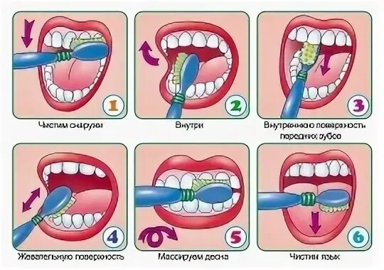 Гигиена полости рта алгоритм