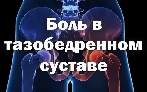 Боли тазобедренного сустава лечение уколы